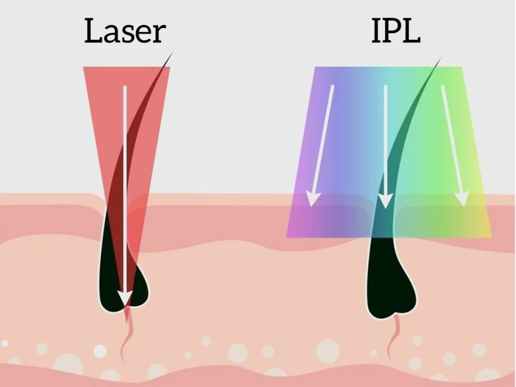 dermasilk image
