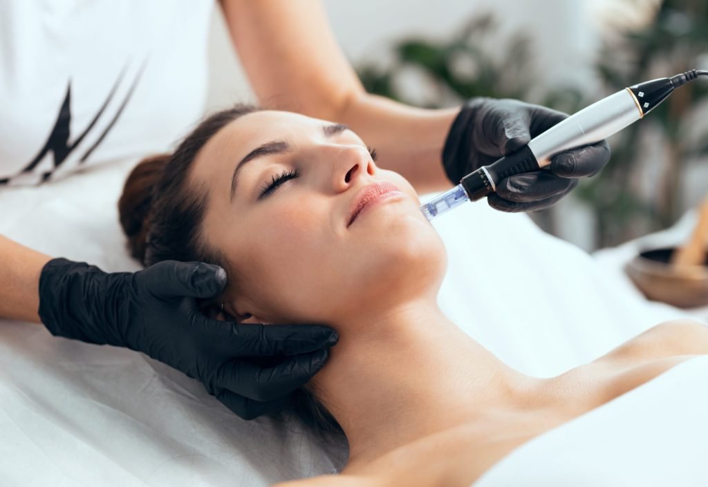 What is Microneedling
